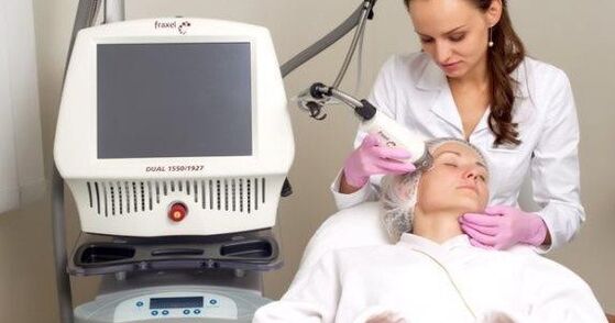 Group rejuvenation with a laser