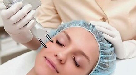Laser rejuvenation of the face